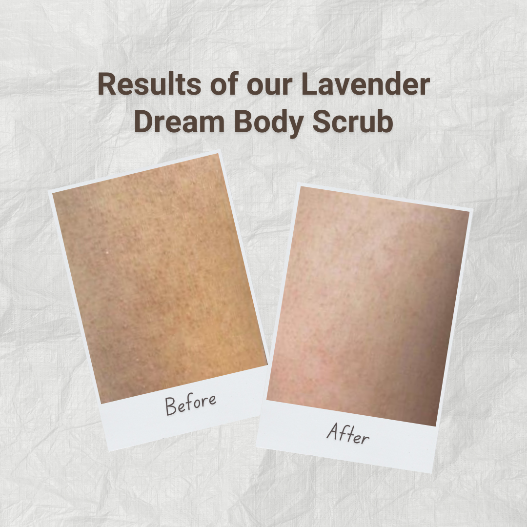 Scalp & Skin Treat