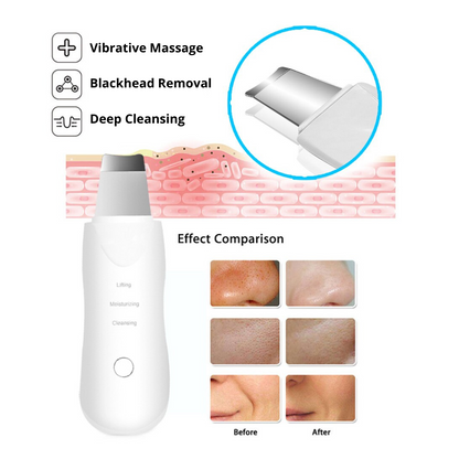 functions of 3 in 1 ultrasonic skin scrubber