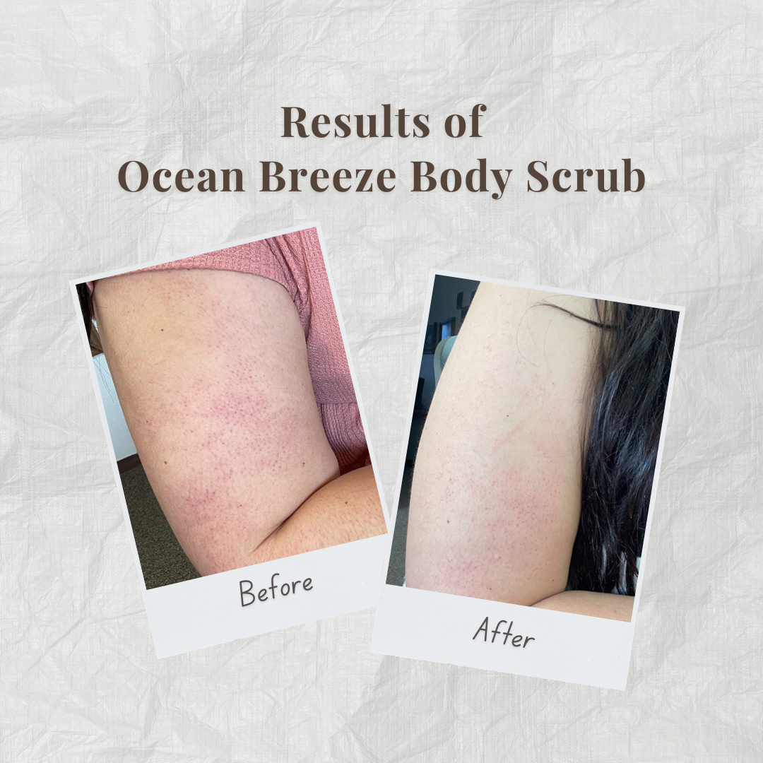 Before and after comparison of ocean breeze body scrub by Auraé Beauty on skin.