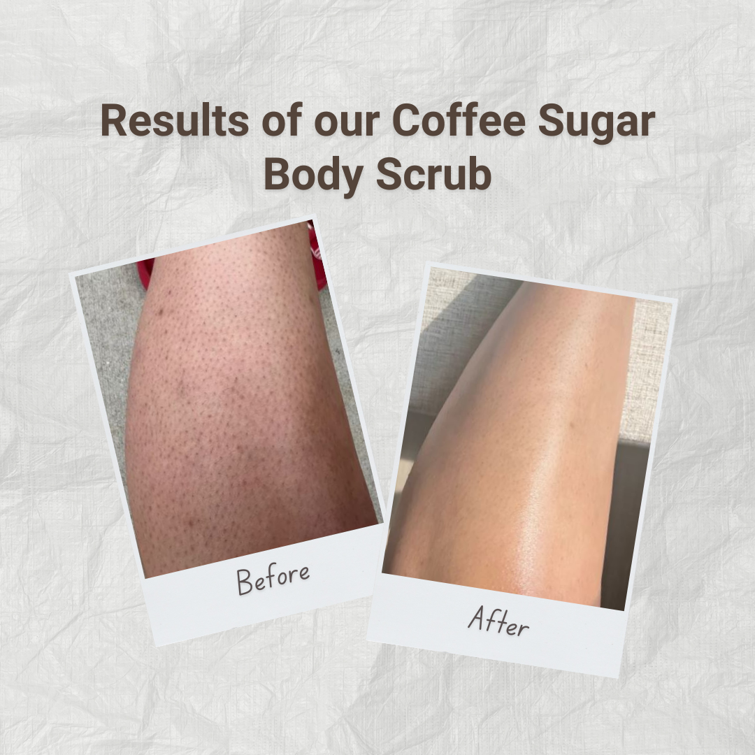Before and after results of Coffee Sugar Body Scrub by Auraé Beauty