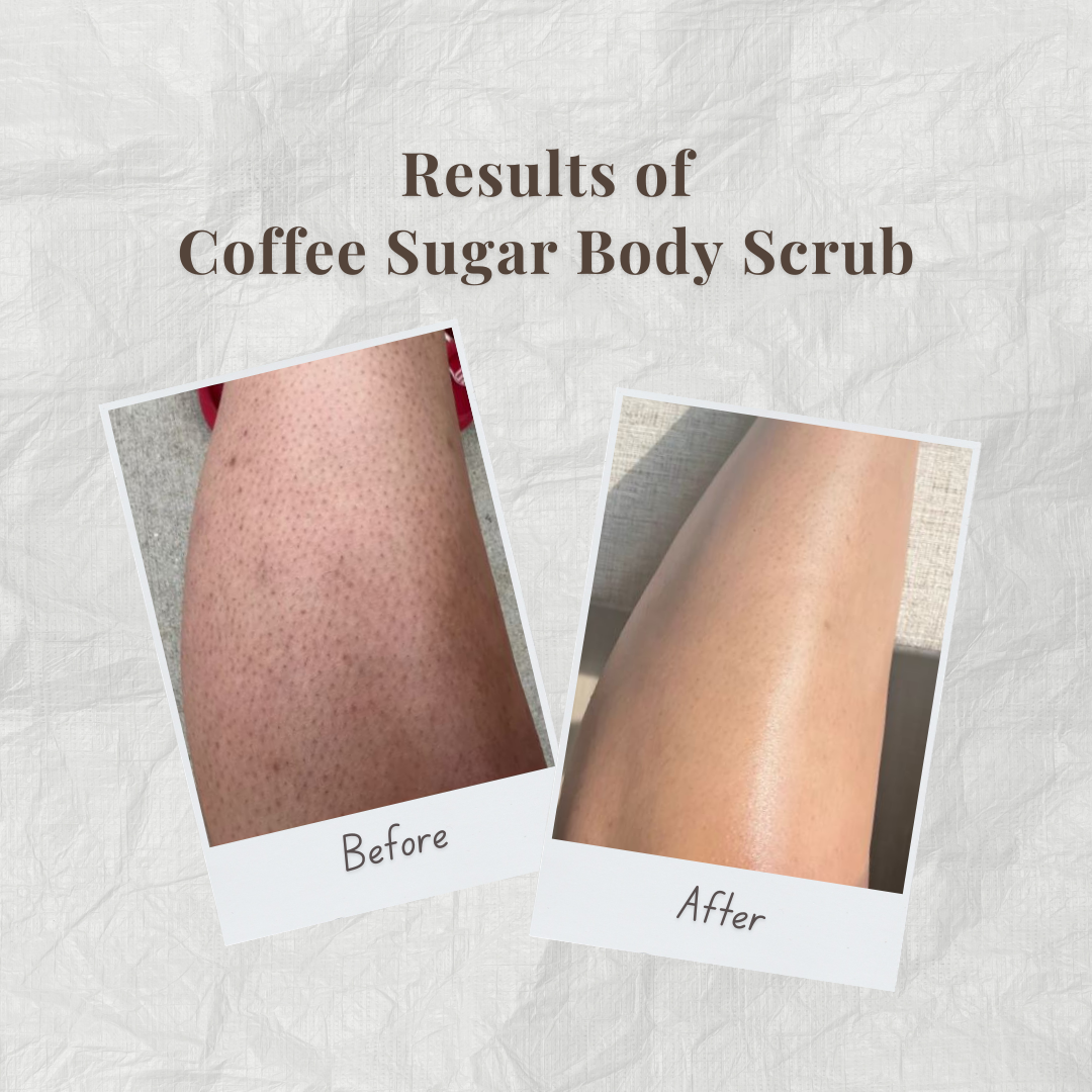 Before and after comparison of coffee sugar body scrub by Auraé Beauty on skin.