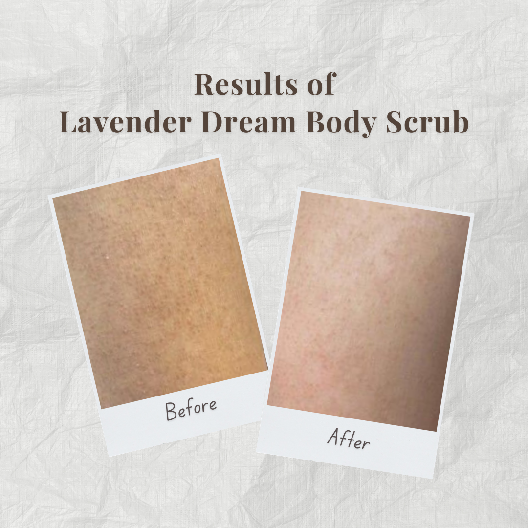 Before and after comparison of Lavender Dream Body Scrub by Auraé Beauty on skin.