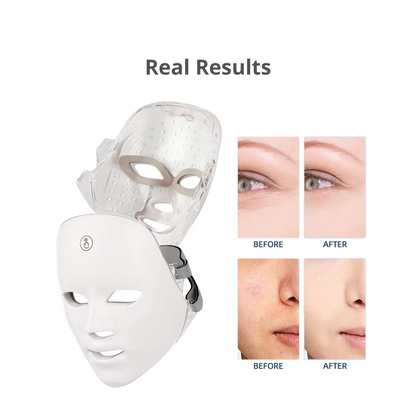 Before and after skincare benefits of LED light therapy face mask with anti aging benefits