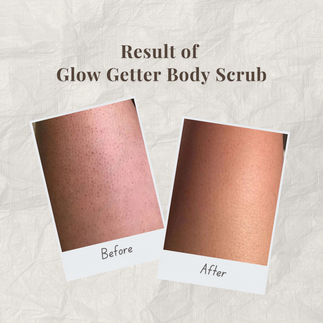 Before and after comparison of Glow Getter Body Scrub by Auraé Beauty on skin.