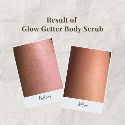 Before and after comparison of Glow Getter Body Scrub by Auraé Beauty on skin.