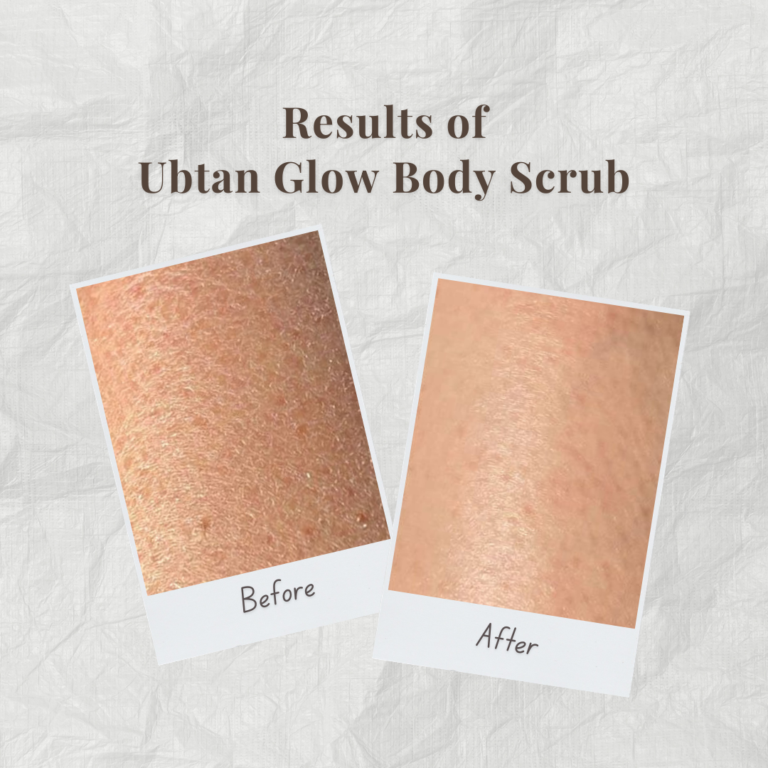 Before and after comparison of Ubtan Glow Body Scrub by Auraé Beauty on skin.