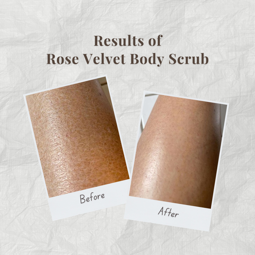 Before and after results of Rose Velvet Body Scrub by Auraé Beauty on skin.