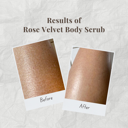 Before and after results of Rose Velvet Body Scrub by Auraé Beauty on skin.