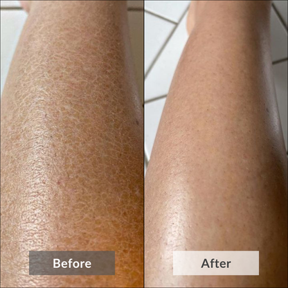 The picture shows the visible results of using Coffee Sugar Body Scrub by Auraé Beauty that is made of 100% organic ingredients and the best for body odor, uneven skin, dull and dry skin.