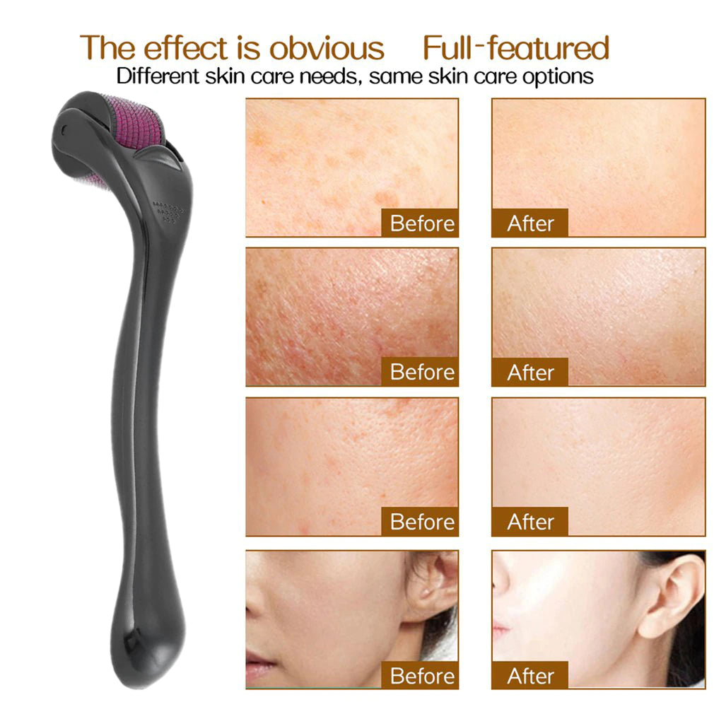 Before and after of using derma roller on the skin