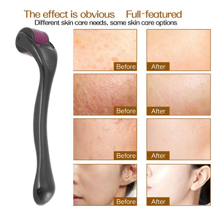 Before and after of using derma roller on the skin